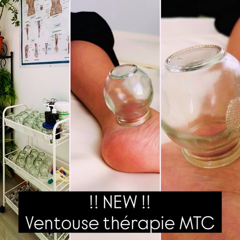 Ventouses thérapie MTC